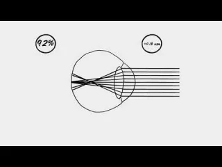 Ultra for Presbyopia (6 lentilles)