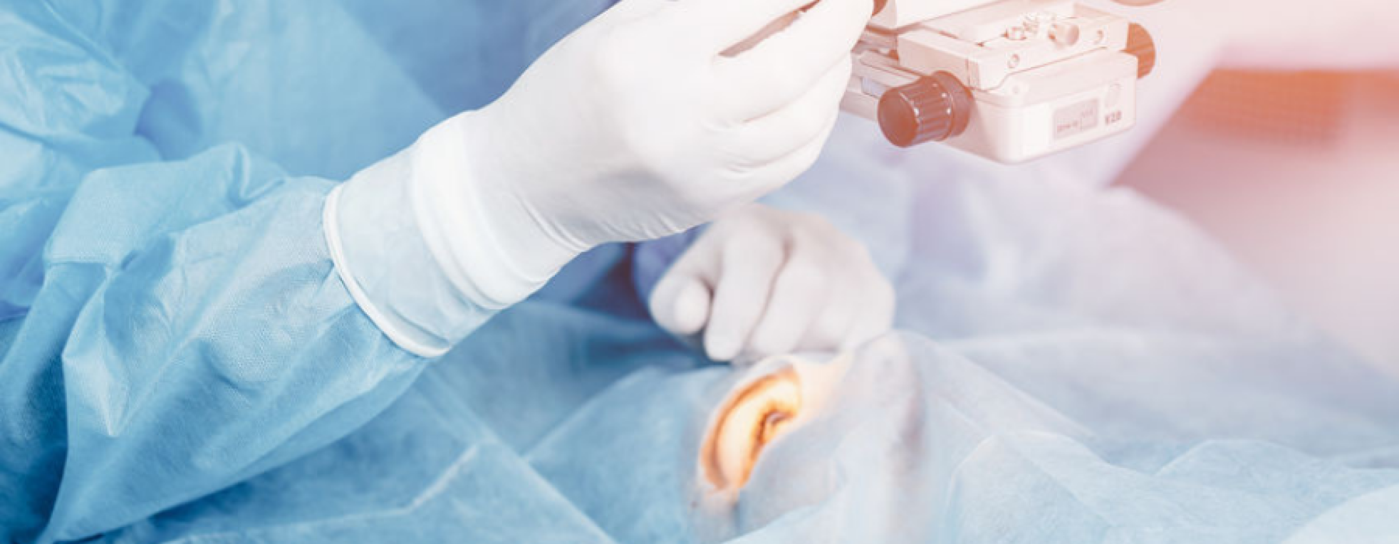 Ogen laseren: de uitleg, kosten en mogelijkheden